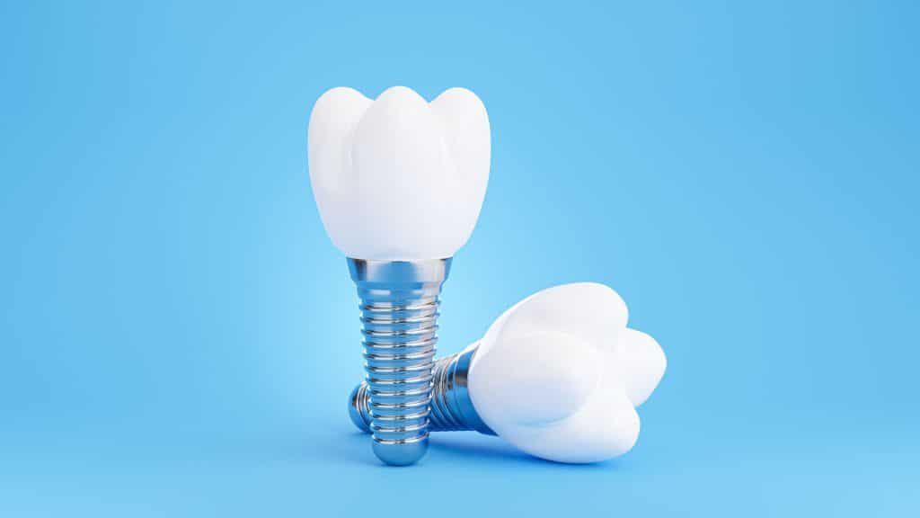 dental implants